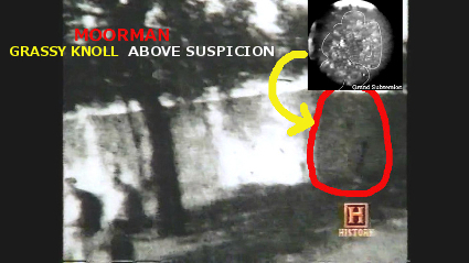 jfk assassination Conspiracy grassy knoll shooter gunman picture enhanced 