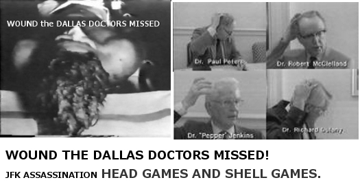 jfk kennedy witnesses head wound shot assassination doctors dallas photos pictures autopsy head wound shot mistake