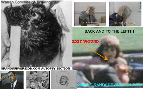 jfk assassination john f kennedy autopsy photos head shot wound who kiled conspiracy
