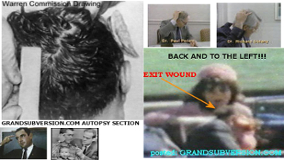 jfk kennedy assassination head shot wound autopsy photo headshot gunshot picture pic