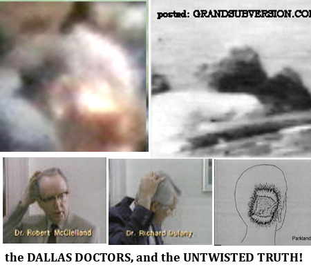 JFK ASSASSINATION conspiracy photos who killed john kennedy shot images evidence facts proof