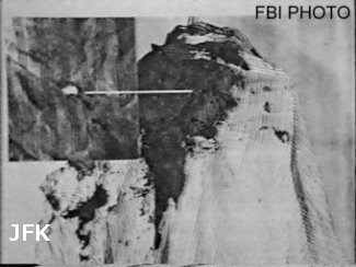 jfk autopsy photo picture cloth wound shot location
