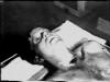 autopsy medical  photo picture photograph image site link search jfk assassination