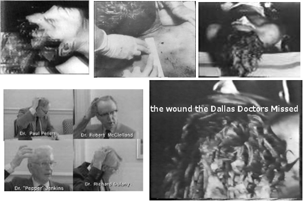 jfk assassination Kennedy photo Dallas doctors autopsy parkland hospital description wounds