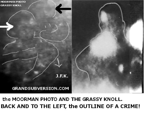 JOHN F KENNEDY JFK ASSASSINATION PRESIDEND conspiracy theories cover-up GRASSY KNOLL pictures photos image